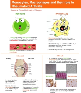 Thumbnail-Monocytes, macrophages and their role in rheumatoid arthritis