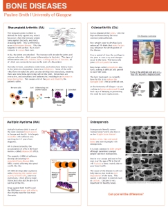 Thumbnail-Bone diseases