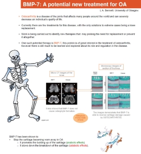 Thumbnail-BMP 7 - a potential new treatment for osteoarthritis